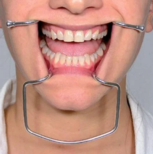 Oringer samoczynne utrzymywanie policzków metalowe drut średni dentysta najlepszy wybór