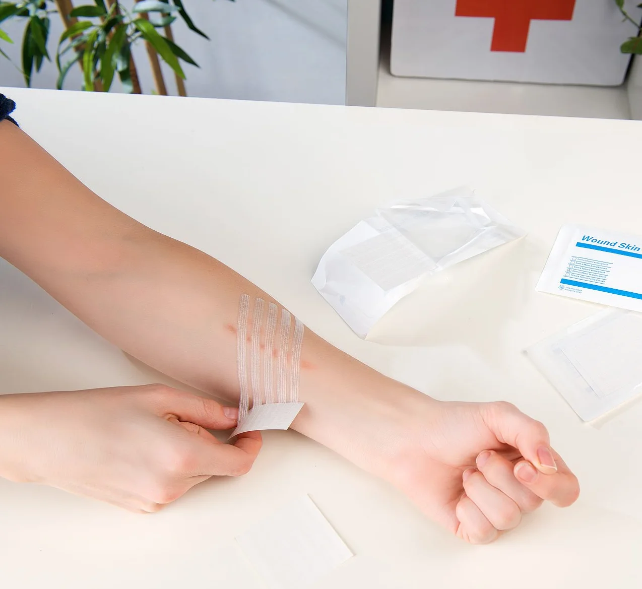 30 pasków do szybkiego szycia – 102 x 6 mm [Newgen Medicals]